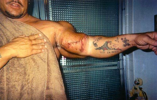 ΑΠΙΣΤΕΥΤΟ: Έσκασε ο μυς του και έσκισε το δέρμα του! - Φωτογραφία 3