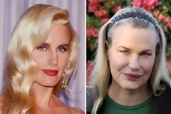 Διάσημοι, παραμορφωμένοι από πλαστικές