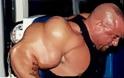 Ακόμα ένα θύμα του bodybuilding που χρησιμοποίησε την ουσία synthol - Φωτογραφία 9