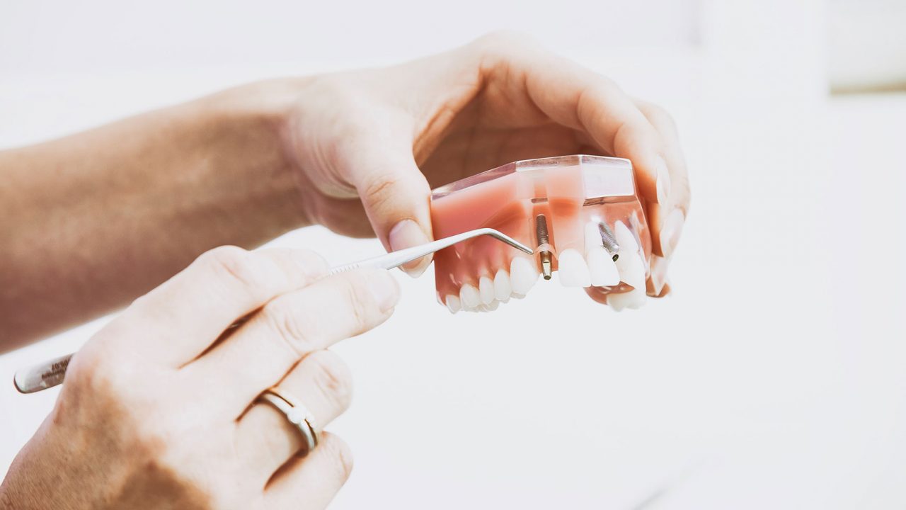 Οδοντίατρος αφαίρεσε το μεγαλύτερο δόντι του κόσμου - Φωτογραφία 1