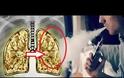 Ηλεκτρικό τσιγάρο: Πνεύμονας ποπ κορν όπως αυτών που εργάζονται σε φούρνους μικροκυμάτων