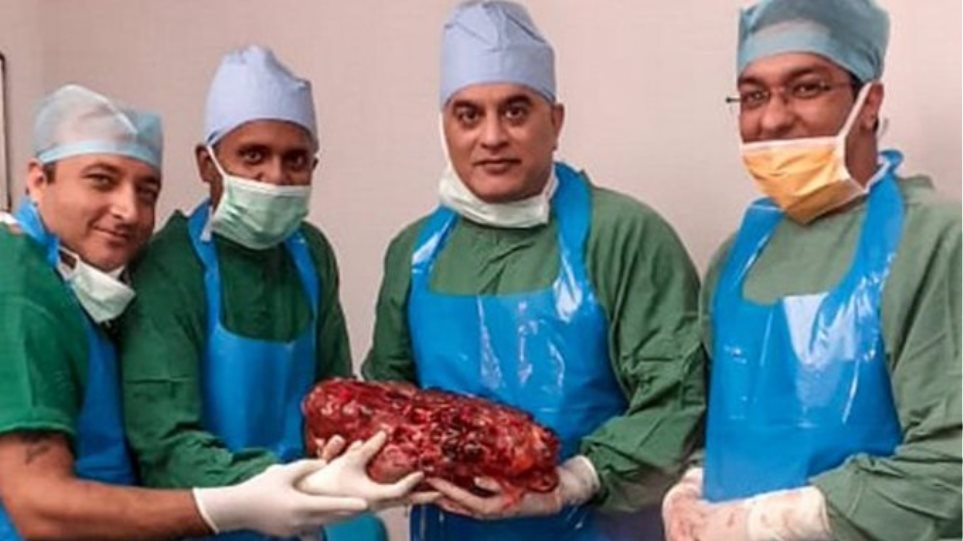 Νεφρό βάρους 7,4 κιλών αφαιρέθηκε από ασθενή - Φωτογραφία 1