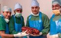 Νεφρό βάρους 7,4 κιλών αφαιρέθηκε από ασθενή