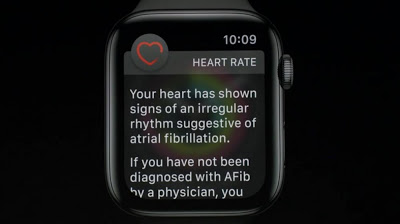Το Apple Watch έσωσε τη ζωή ανθρώπου με κολπική μαρμαρυγή - Φωτογραφία 1
