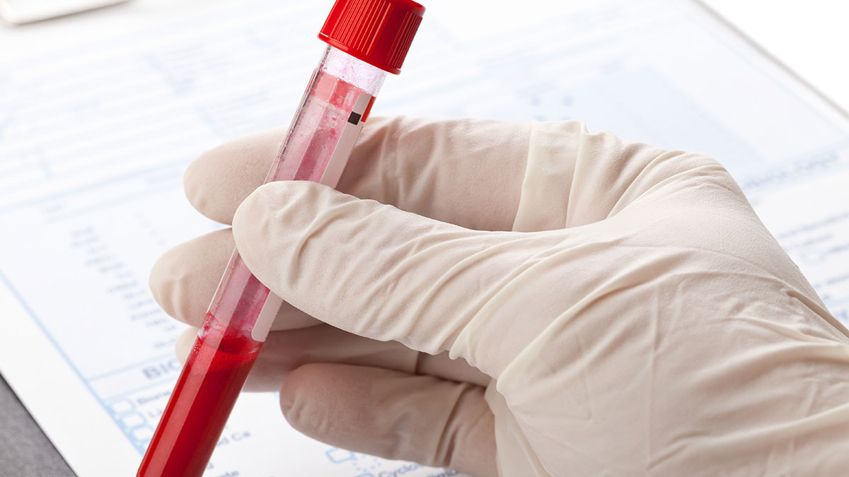Εξετάσεις αίματος: Ο παράγοντας που μπορεί να αλλοιώσει τα αποτελέσματα - Φωτογραφία 1