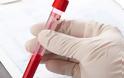 Εξετάσεις αίματος: Ο παράγοντας που μπορεί να αλλοιώσει τα αποτελέσματα