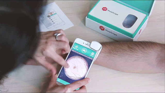 Πώς να χρησιμοποιήσετε το smartphone σας για να ελέγξετε για καρκίνο του δέρματος - Φωτογραφία 1