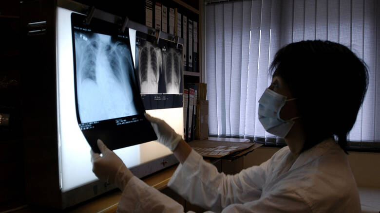 Μυστηριώδης πνευμονία προκαλεί ανησυχία στην Κίνα - Φωτογραφία 1