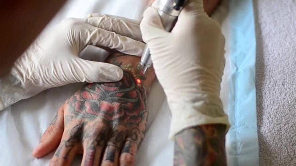 Η E.E. ζητά την απαγόρευση των τατουάζ μπλε και πράσινου χρώματος - Φωτογραφία 1