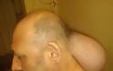 Κρατούμενος στις φυλακές Νιγρίτας εκπέμπει SOS: «Έβγαλα 2ο κεφάλι» - Φωτογραφία 2