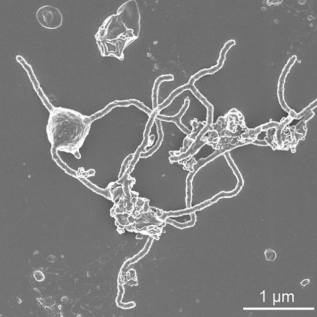 H προέλευση πολύπλοκων μορφών ζωής στη Γη μέσα από ένα παράξενο μικρόβιο - Φωτογραφία 1