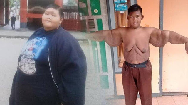 ΣΟΚ: Αυτό το παιδί ζύγιζε 190 κιλά - Δείτε πώς είναι σήμερα (pics) - Φωτογραφία 1