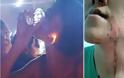 Βίντεο: Νεαρή ήπιε σφηνάκι τεκίλα με... φωτιά και κάηκε το πρόσωπό της