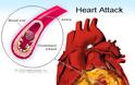 ΠΡΟΣΟΧΉ συμπτώματα που προειδοποιούν για έμφραγμα, καρδιακή προσβολή και πρέπει να πάτε άμεσα σε καρδιολόγο - Φωτογραφία 2