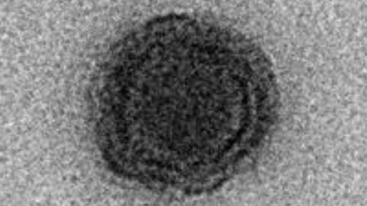 Yaravirus : Μυστηριώδης ιός εντοπίστηκε στη Βραζιλία - Φωτογραφία 1