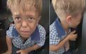 Βίντεο: 9χρονο αγόρι που πάσχει από νανισμό, κλαίει σπαρακτικά λόγω του bullying που δέχεται στο σχολείο