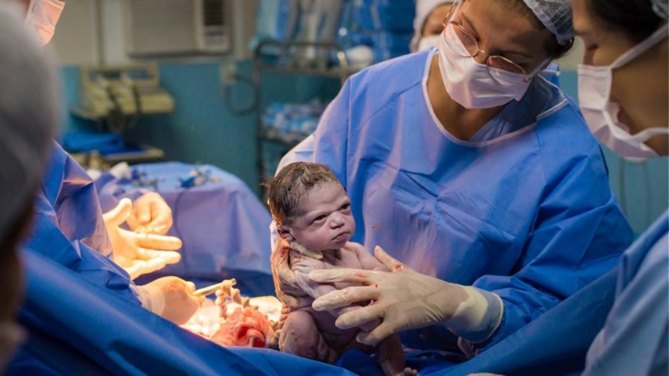 Viral φωτο: Νεογέννητο κοιτά με νεύρα τον μαιευτήρα - Φωτογραφία 1
