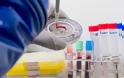 Πέντε πρωτότυπα εμβόλια κατά του κοροναϊού αναπτύσσει η Ρωσία