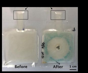 Νέο απλό τεστ από χαρτί εντοπίζει βακτηριακές λοιμώξεις - Φωτογραφία 2