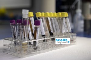 Κοροναϊός: Το διπλό τεστ στα νοσοκομεία που εντοπίζει τα «κρυφά» κρούσματα! Πως εφαρμόζεται - Φωτογραφία 3