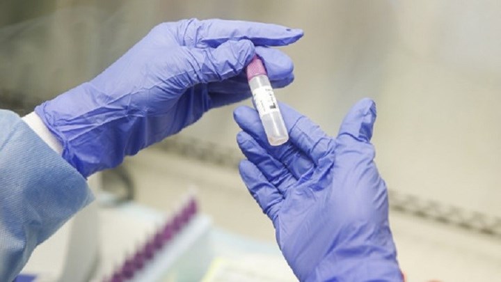 Κορονοϊός - Ρωσία: Ξεκίνησαν δοκιμές εμβολίου σε ζώα - Φωτογραφία 1