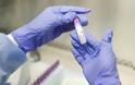 Κορονοϊός - Ρωσία: Ξεκίνησαν δοκιμές εμβολίου σε ζώα