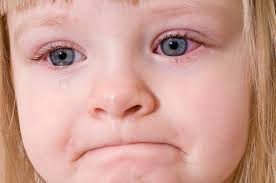Επιπεφυκίτιδα με τσίμπλα, δάκρυα, πρήξιμο, κόκκινα ερεθισμένα μάτια - Φωτογραφία 4