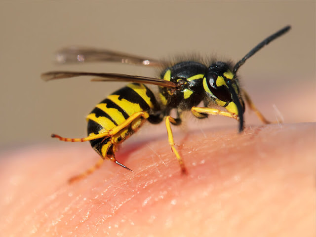 Πρώτες βοήθειες για τσίμπημα μέλισσας, σφήκας (σφίγγας ή σφήγκας). Πώς να αφαιρέσετε το κεντρί; Αντιμετώπιση αλλεργικής αντίδρασης - Φωτογραφία 1