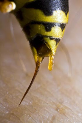Πρώτες βοήθειες για τσίμπημα μέλισσας, σφήκας (σφίγγας ή σφήγκας). Πώς να αφαιρέσετε το κεντρί; Αντιμετώπιση αλλεργικής αντίδρασης - Φωτογραφία 2