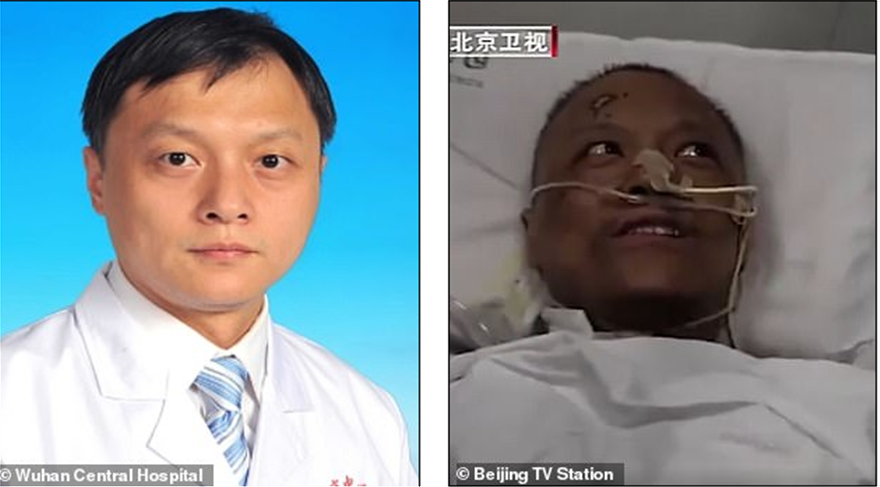 Μαύρο... έγινε το δέρμα δύο Κινέζων γιατρών που νόσησαν από τον ιό - Φωτογραφία 2