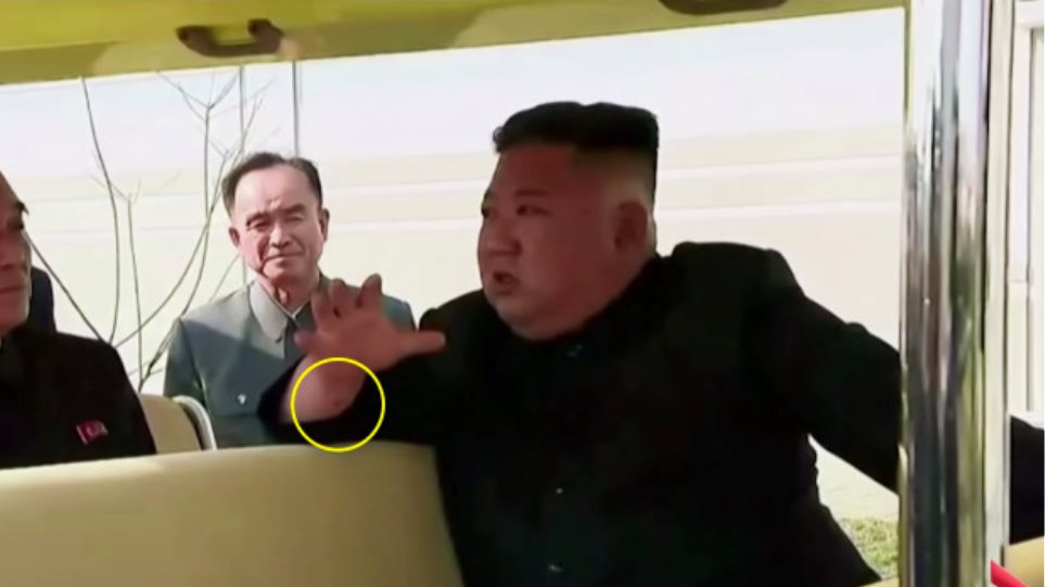 Κιμ Γιονγκ Ουν: Η «επιστροφή» και το μυστηριώδες σημάδι στο δεξί του χέρι - Φωτογραφία 1