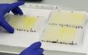 Μονοκλωνικό αντίσωμα που μπλοκάρει τη μόλυνση από τον κορωνοϊό ανακάλυψαν Ολλανδοί επιστήμονες