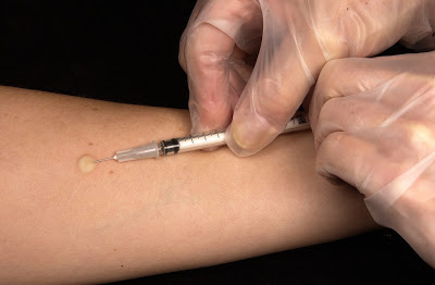 Μόσιαλος: Οι εμβολιασθέντες για φυματίωση στην παιδική ηλικία δεν προστατεύονται από κοροναϊό - Φωτογραφία 1