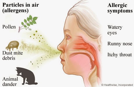 Αλλεργία. Τι είναι και πώς μπορεί να αντιμετωπιστούν οι αλλεργίες; Υπάρχει τρόπος πρόληψης; - Φωτογραφία 6