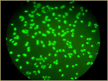 Ουρεόπλασμα Ureaplasma urealyticum. Σεξουαλικώς μεταδιδόμενο βακτήριο που προκαλεί τσούξιμο, πόνο, εκκρίσεις - Φωτογραφία 5