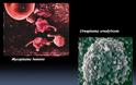 Ουρεόπλασμα Ureaplasma urealyticum. Σεξουαλικώς μεταδιδόμενο βακτήριο που προκαλεί τσούξιμο, πόνο, εκκρίσεις - Φωτογραφία 3