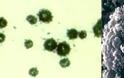 Ουρεόπλασμα Ureaplasma urealyticum. Σεξουαλικώς μεταδιδόμενο βακτήριο που προκαλεί τσούξιμο, πόνο, εκκρίσεις - Φωτογραφία 4