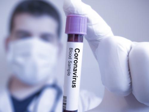 Εμβόλιο: Οι ερευνητές του Πανεπιστημίου της Οξφόρδης μαζί με την AstraZeneca προχωρούν τις κλινικές δοκιμές - Φωτογραφία 1