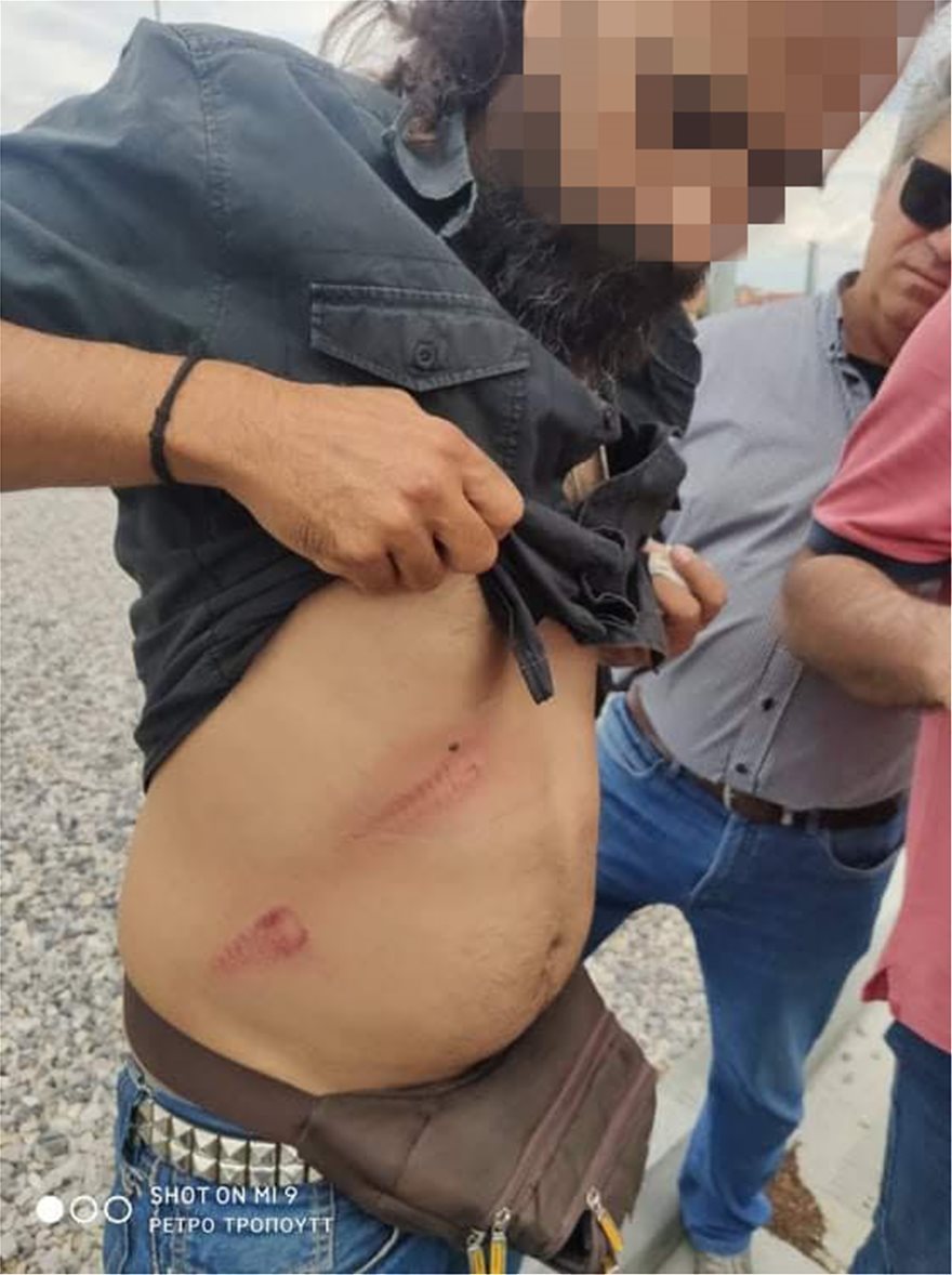 Μαλακάσα: Κάτοικοι τραυματίστηκαν - Φωτογραφία 4