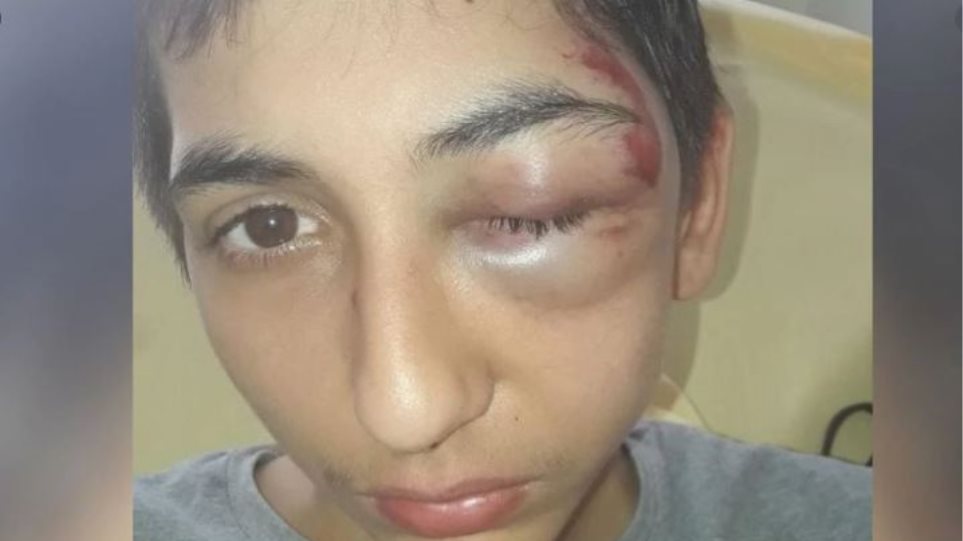 Γαλλία: Σάλος για υπόθεση «ζαρντινιέρα» με 14χρονο Ρομά - Φωτογραφία 1