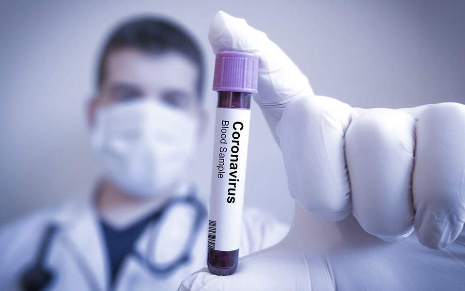 Το εμβόλιο του κορωνοϊού,ακόμη κι αν βρεθεί,θα χρειαστεί 3 χρόνια για να φθάσει στην Ελλάδα.. - Φωτογραφία 1
