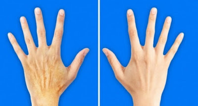 5 Μυστικά για να δείχνουν τα χέρια σου 10 χρόνια νεότερα - Φωτογραφία 1