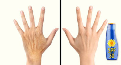 5 Μυστικά για να δείχνουν τα χέρια σου 10 χρόνια νεότερα - Φωτογραφία 6