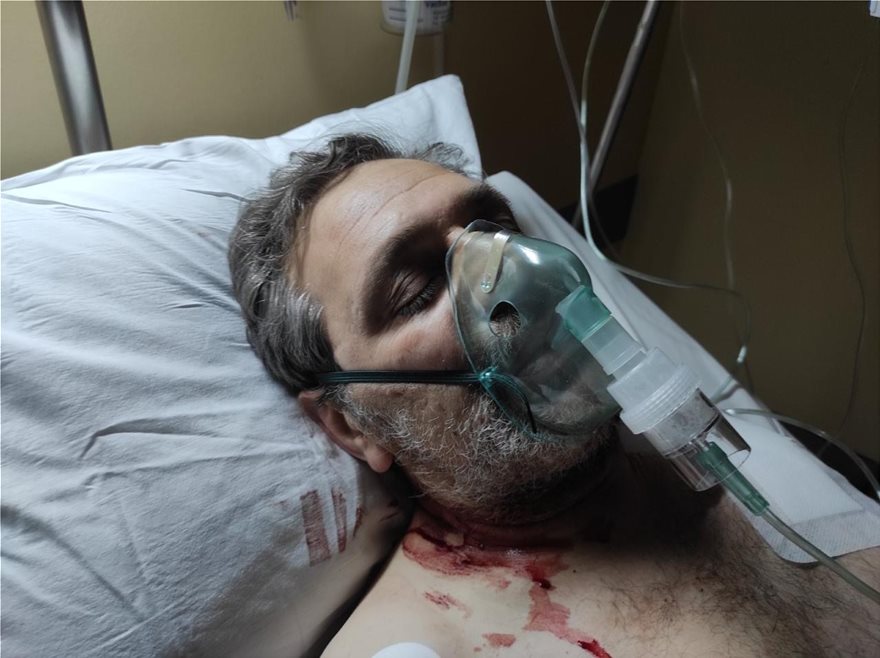 Πυροβόλησαν τον δημοσιογράφο Στέφανο Χίο - Φωτογραφία 2