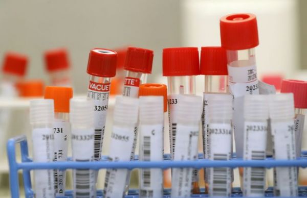 Κοροναϊός : Νέο τεστ για την ταχεία ανίχνευση του ιού στο σάλιο - Φωτογραφία 2