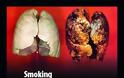 Προσοχή. Ο καρκίνος του πνεύμονα συχνά ΔΕΝ παρουσιάζει συμπτώματα. Αποτελεί την τρίτη συχνότερη μορφή καρκίνου - Φωτογραφία 5