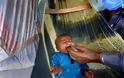 Τεράστια επιτυχία. ΠΟΥ. Εξαλείφθηκε η πολιομυελίτιδα από την Αφρική