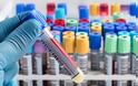 Sanofi σταματά τις δοκιμές φαρμάκου για την καταπολέμηση του ιού