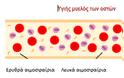 Αιματολογικοί καρκίνοι, Μυελοϋπερπλαστικά Νεοπλάσματα. Μυελοΐνωση, Αληθής Πολυκυτταραιμία, Ιδιοπαθής Θρομβοκυττάρωση - Φωτογραφία 3