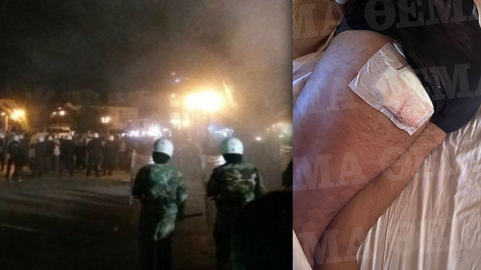 Ορεστιάδα - Άγρια επίθεση σε αστυνομικούς: «Μας φώναζαν θα πεθάνετε» - Φωτογραφία 1